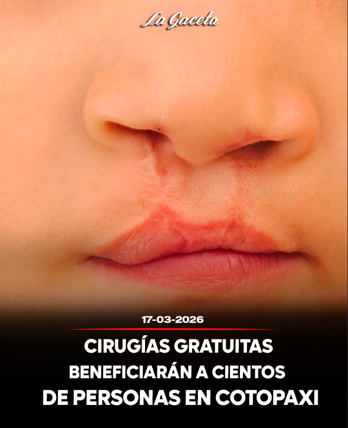 Cirugías gratuitas beneficiarán a cientos de personas en Cotopaxi