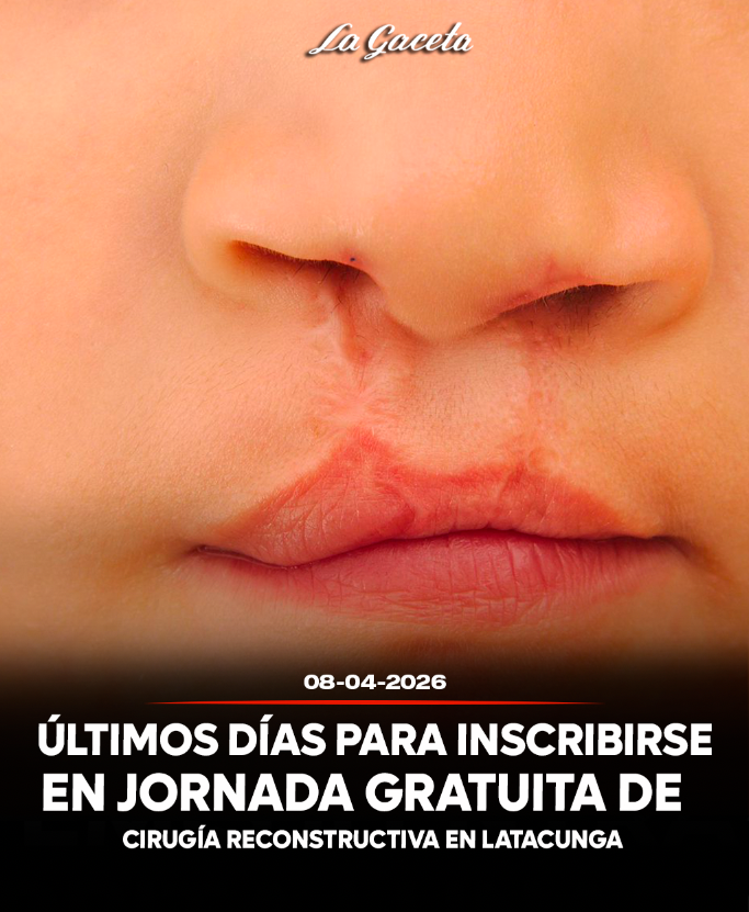 Últimos días para inscribirse en jornada gratuita de cirugía reconstructiva en Latacunga